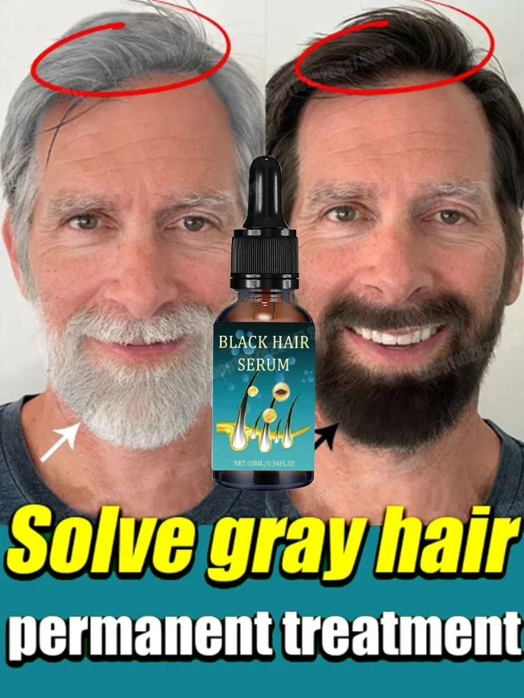 Natural and Healthy White To Black hair No hair color,no allergies Anti-grey quickly turns white hair into black