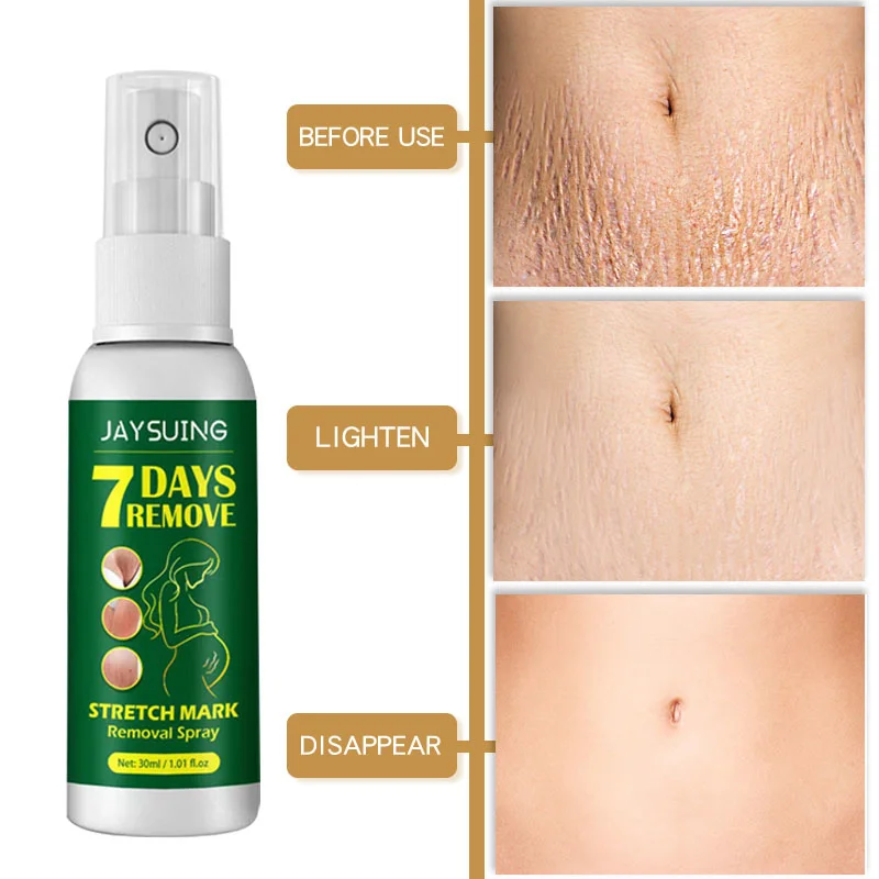 7 Days Stretch Marks Spray For Pregnancy Remove Postpartum Obesity Women Scar Without Side Effect Butt Firm Lift Skin Body Cream