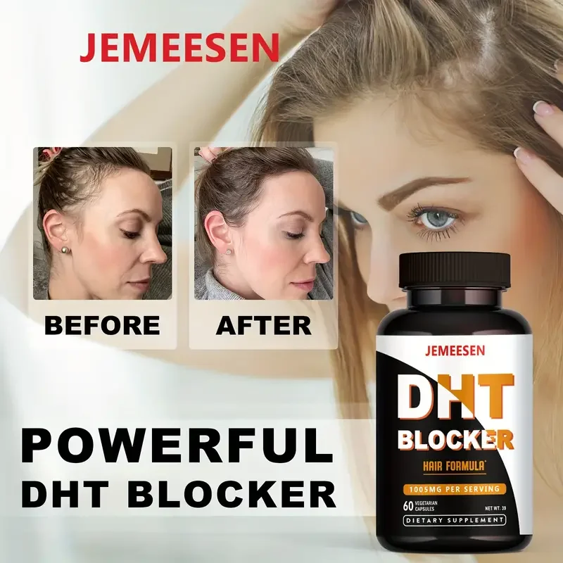 DHT Blocker Hair Growth Supplement - High Efficiency Biotin And Saw Palmetto For Hair Regrowth - Natural Hair Loss Treatment For