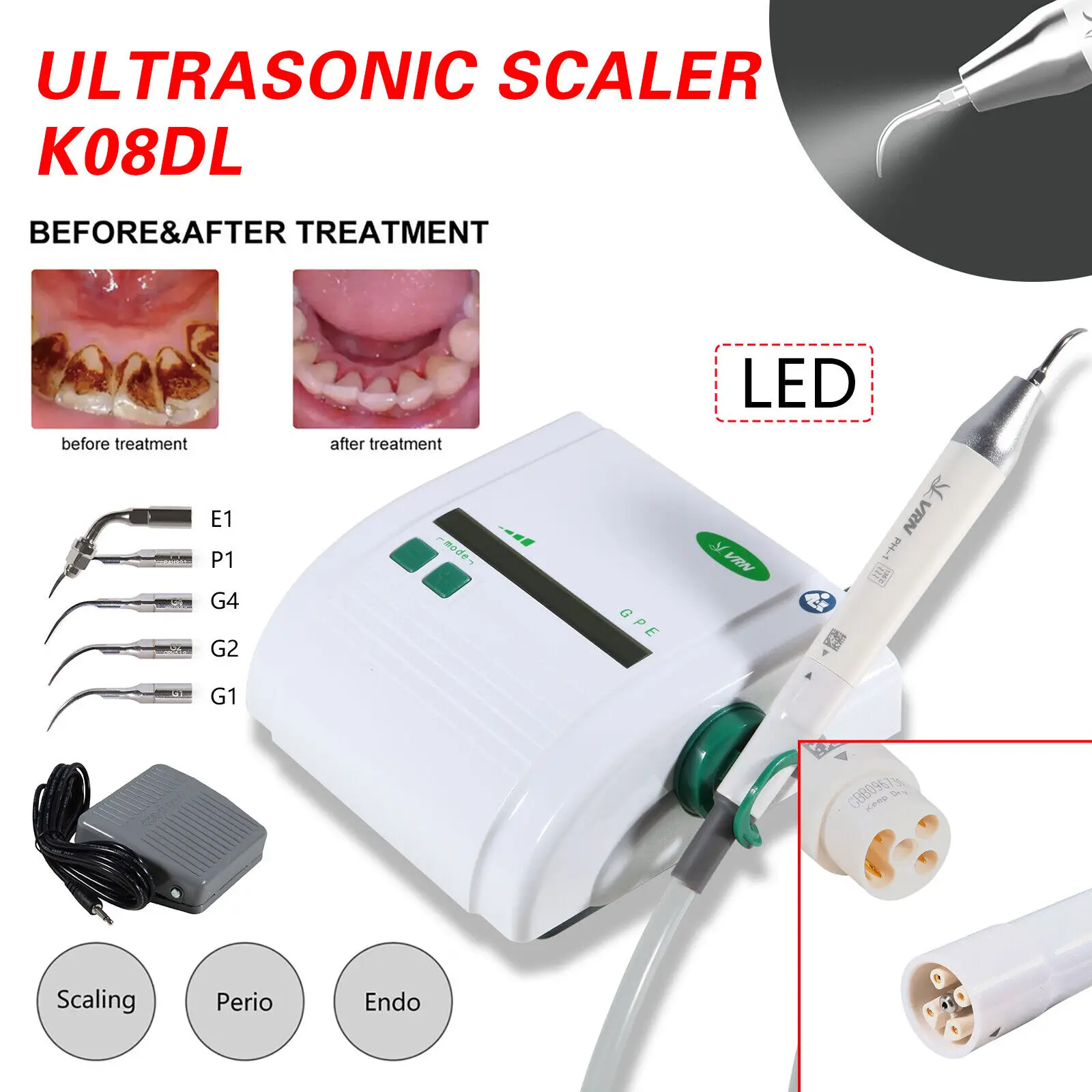 Escarificador ultrasónico Dental, pieza de mano desmontable Autoclavable con 5 puntas de piezas, compatible con EMS + LED, VRN