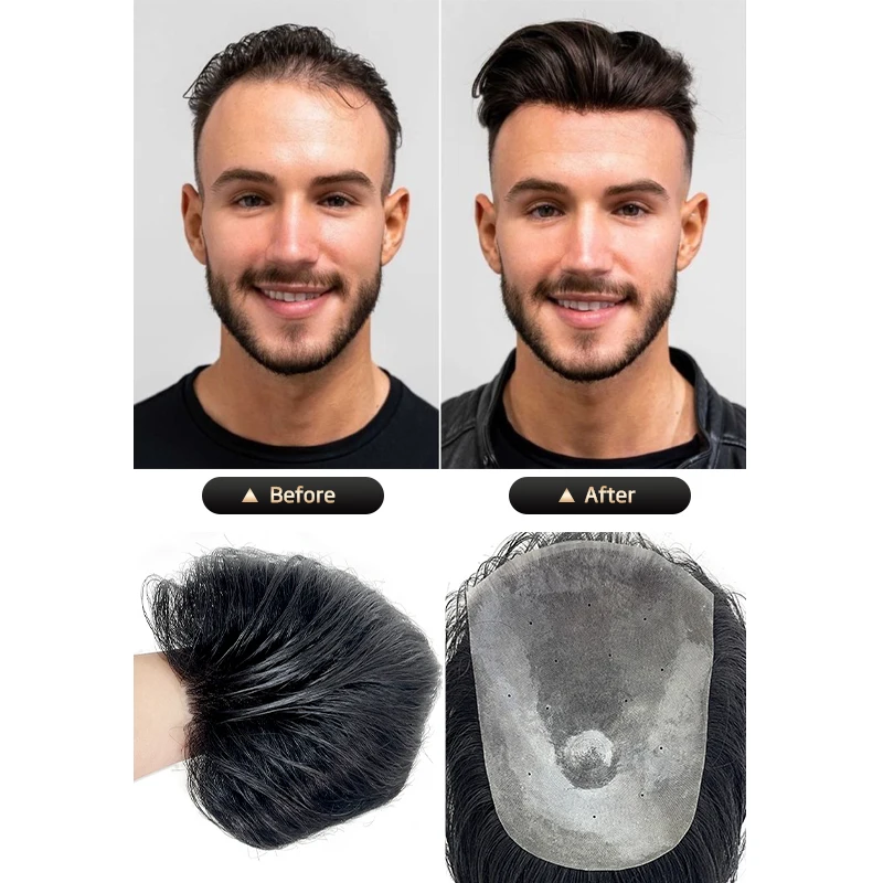 100% الشعر البشري 15*20 سنتيمتر بولي Men الرجال الطبيعية أملس الظهر نمط الشعرية الاصطناعية غطاء فعال ترقق الشعر شعر مستعار الذكور