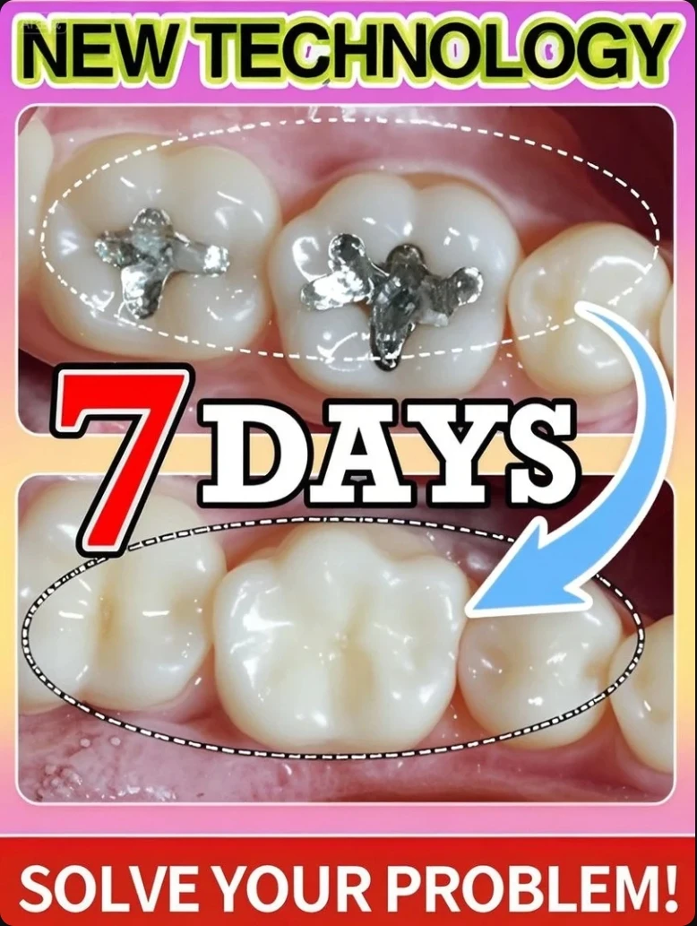 

2025 Tooth decay repair all tooth decay, cavities and protect teeth Colour Correcting