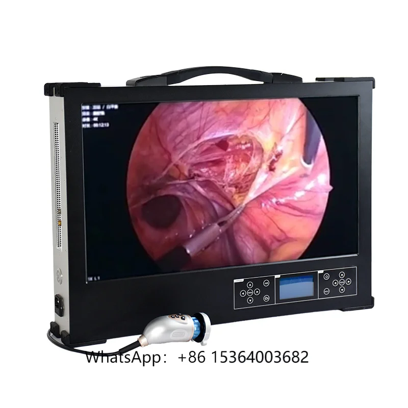 

Portable ENT 24-Inch Medical Inspection Endoscope Rigid with Electric Power Source Durable Metal and Plastic Material