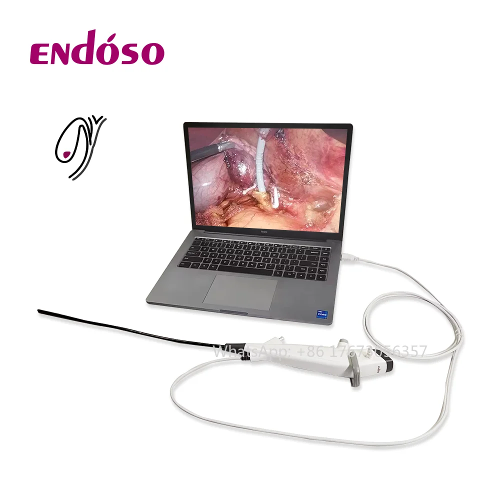 Endoso USB Flexible Electronic Cholangioscopy Choledochoscope For Hepatobiliary Surgery Liver Pancreas Biliary