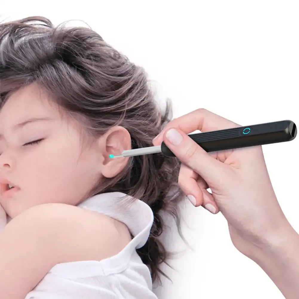 removedor-de-cera-de-ouvido-inteligente-hd-sem-fio-com-visao-noturna-recarregavel-endoscopio-auricular-para-limpeza-e-cuidado-infantil