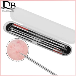 Acne Remover Needle Facial Cleaning Tool Skin Care Double-ended Blackhead Stainless Steel Pimple