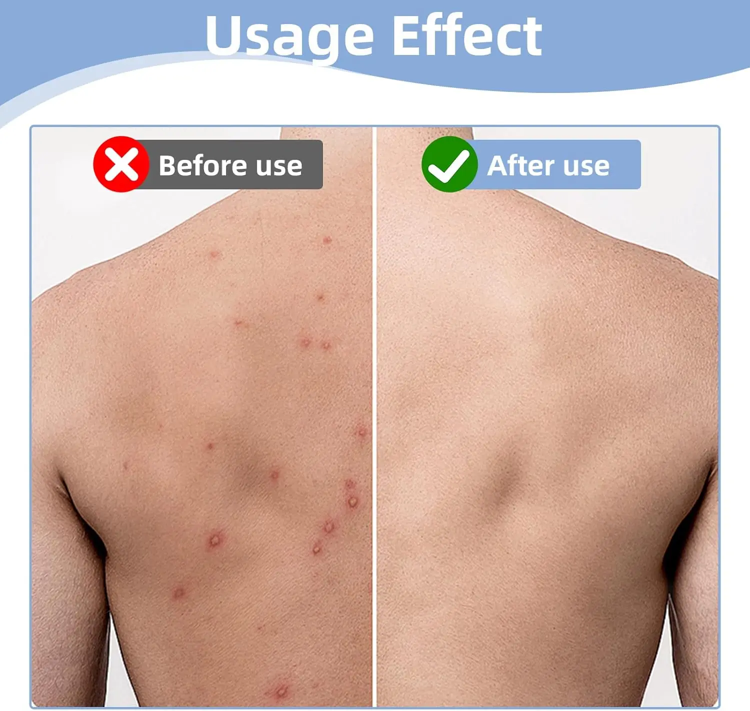 منشفة تقشير الجسم منشفة الظهر لإزالة الجلد الميت والتطهير العميق والتدليك تخلق رغوة غنية للرجال والنساء #5