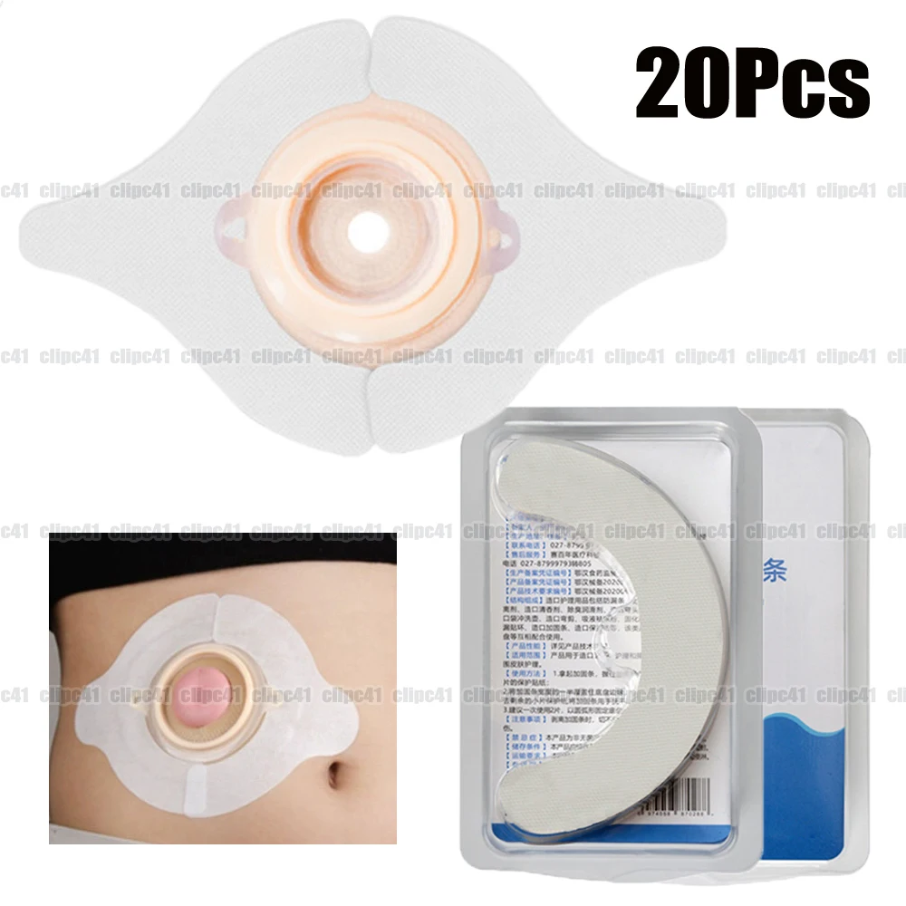 20Pcs Ostomy Barrier Strips Y Shape Adhesive Seal Extender Strip For Colostomy Bags Ileostomy Tape For Stoma Ostomy Bag