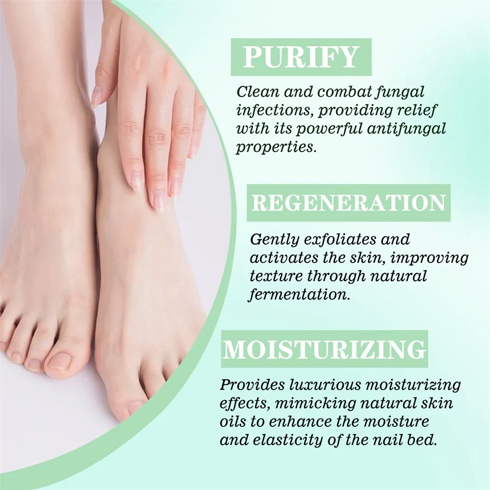 20 ml nagelschimmelbehandelingen gel, nagelverzorging reparatiegel, paronychia antifungals nagel teen nagelschimmelbehandelingen olie voor nagel