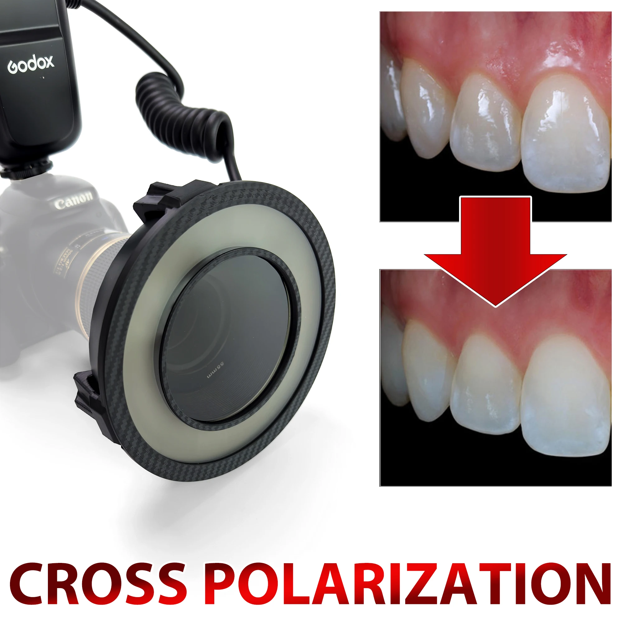 Cross Polarization For Dental Photo Camera Flashes - Godox MF-R76 Flash - Polar Eye - No Reflections, No Glare Photo For Dentist