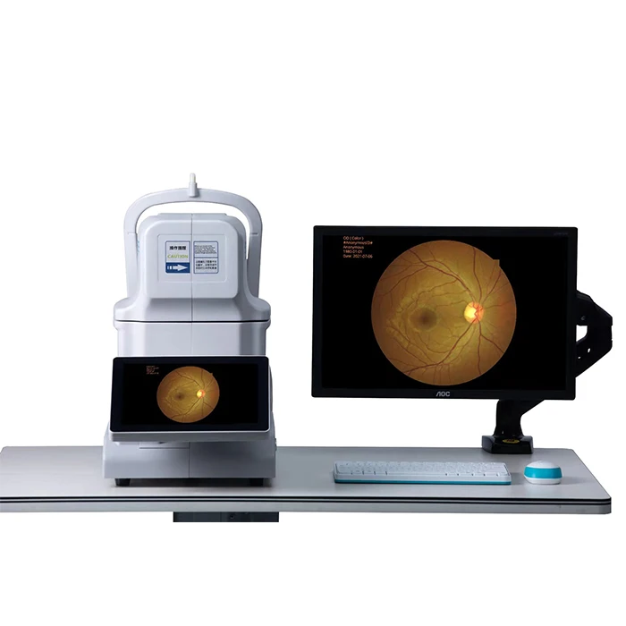 RET-3100B China digital auto retinal camera eye fundus camera
