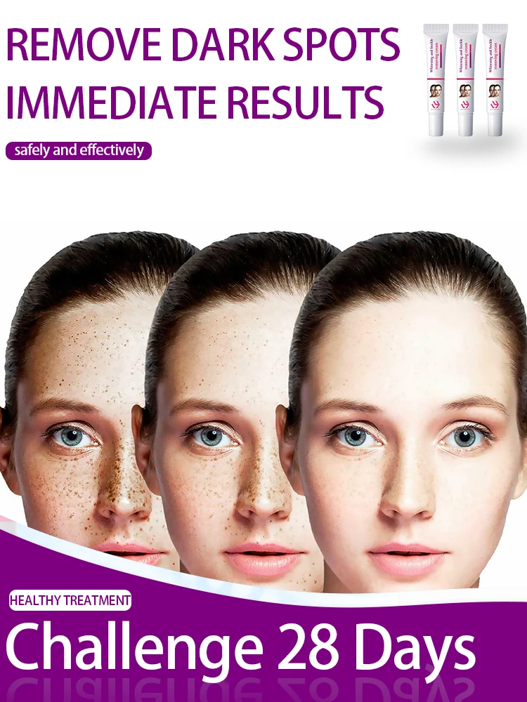 Whitening Freckles Cream Remove Dark Spot Face Cream Lighten Melasma Melanin Pigmentation Anti-Aging Moisturizing Brighten Skin