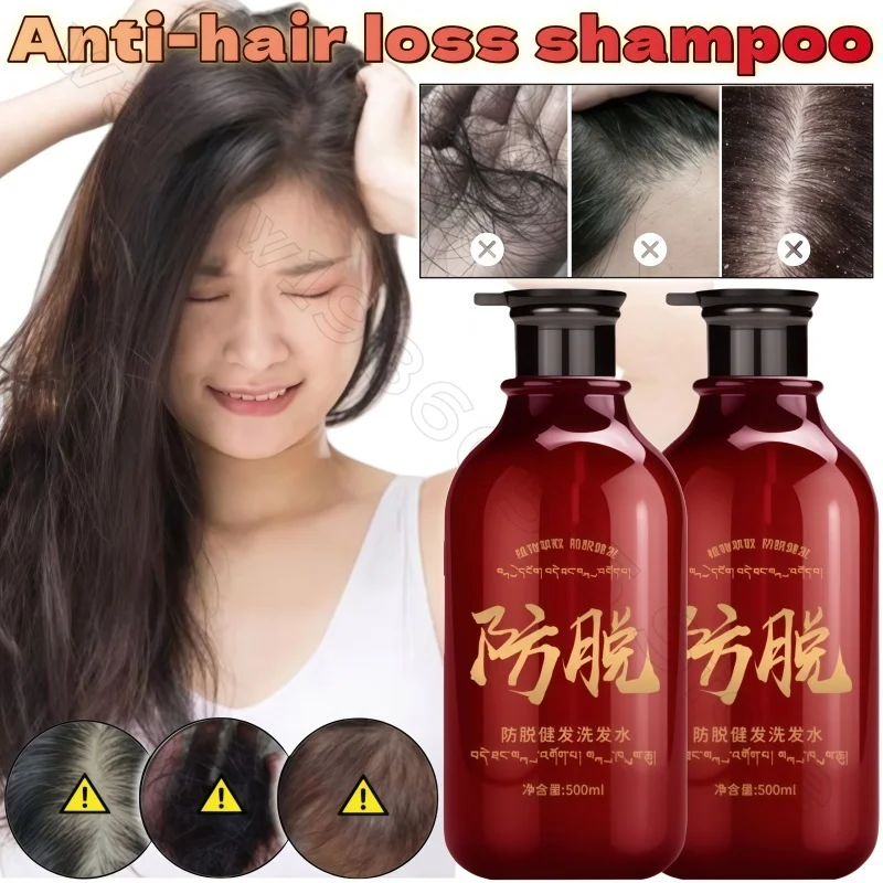 

Polygonum Multiflorum and Ginger Anti-hair Loss Shampoo 500ml Oil Control Fluffy and Strong Hair Root Nourishing Shampoo