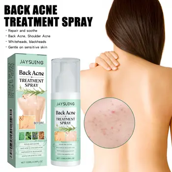 10 best sales Sırt sivilce spreyi - №1