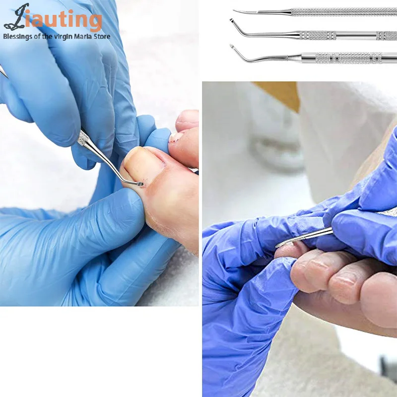 Ensemble d'outils de Correction des ongles incarnés, 6 pièces, limes à ongles à Double extrémité en acier inoxydable, soins Paronychia, outils de nettoyage des pieds