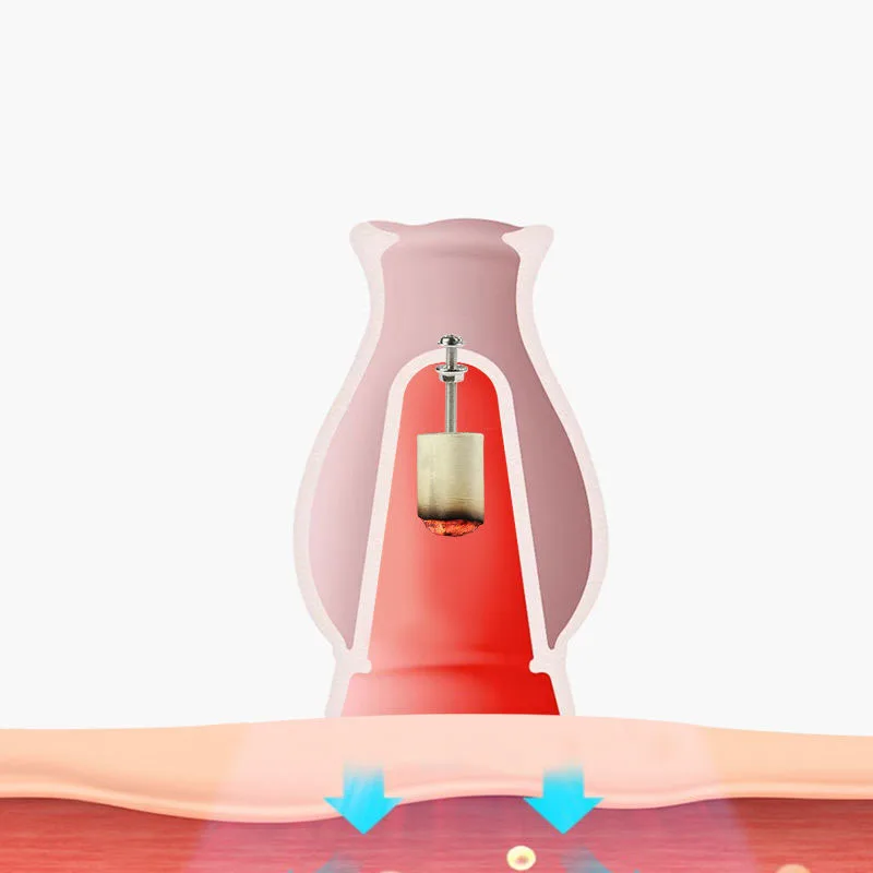 Ceramic Moxibustion Jar Facial Beauty Moxa Therapy Warm Massage Medicine Force Penetration Freckle Beauty Body Health Massager