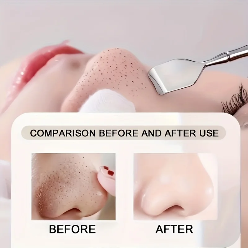 1Pcs Double-Ended Blackhead Remover: Facial Pore Cleanser, Exfoliator, and Massage Tool for Smooth Skin