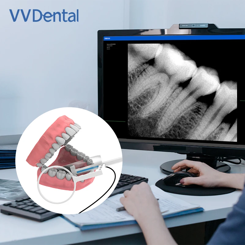 Vvdental dental portátil sensor raio x radiovisiógrafo sensor digital sistema de imagem intraoral hd imagem odontologia sensor ferramentas