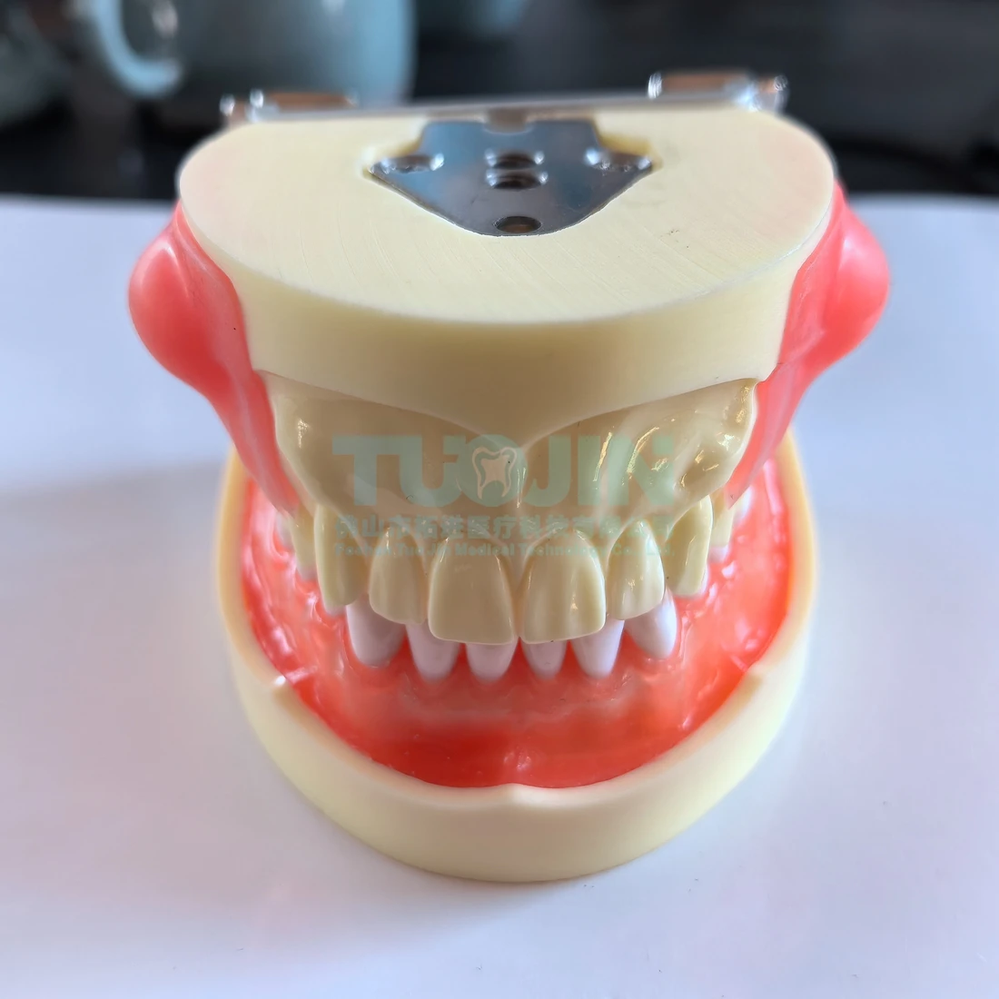 2025 Gingival Cyst Dental Model New Teaching Demonstration Experimental Oral Model for Clinic Display