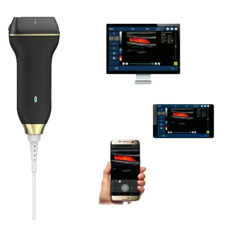 China Handheld Pocket Usb Kleur Doppler Lineaire Sonde Echografie Draagbare Echografie Apparaat