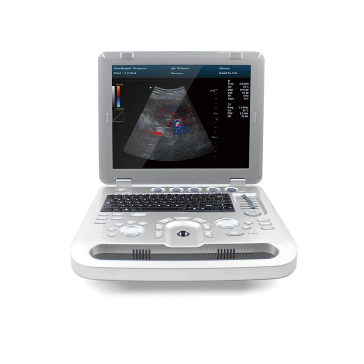 CONTEC 15-Inch Laptop Digital 3D/4D Ultrasound Machine Medical Scanner With CE Certificate At The Cheap Price For Diagnosis