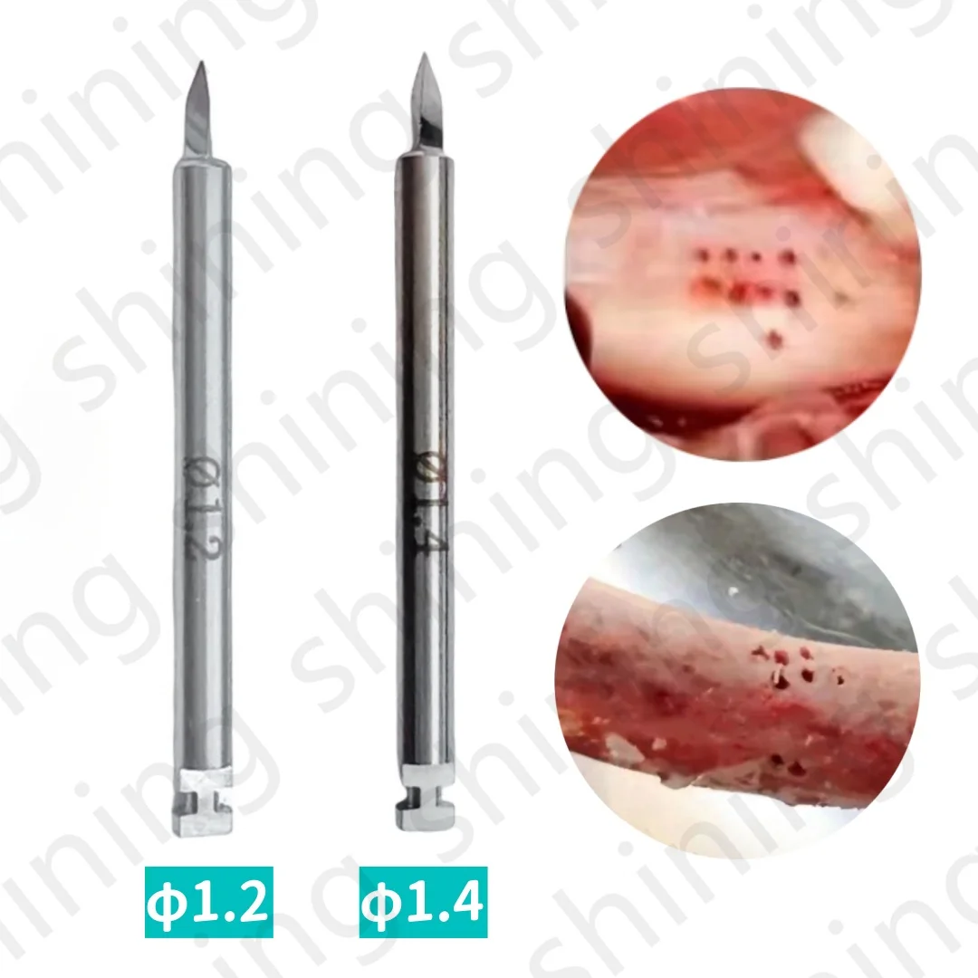 Dental Nutrient Drill Bone Implant Increment Nutrient Hole Drill Dental GBR Pilot Drill Promote New Bone Formation
