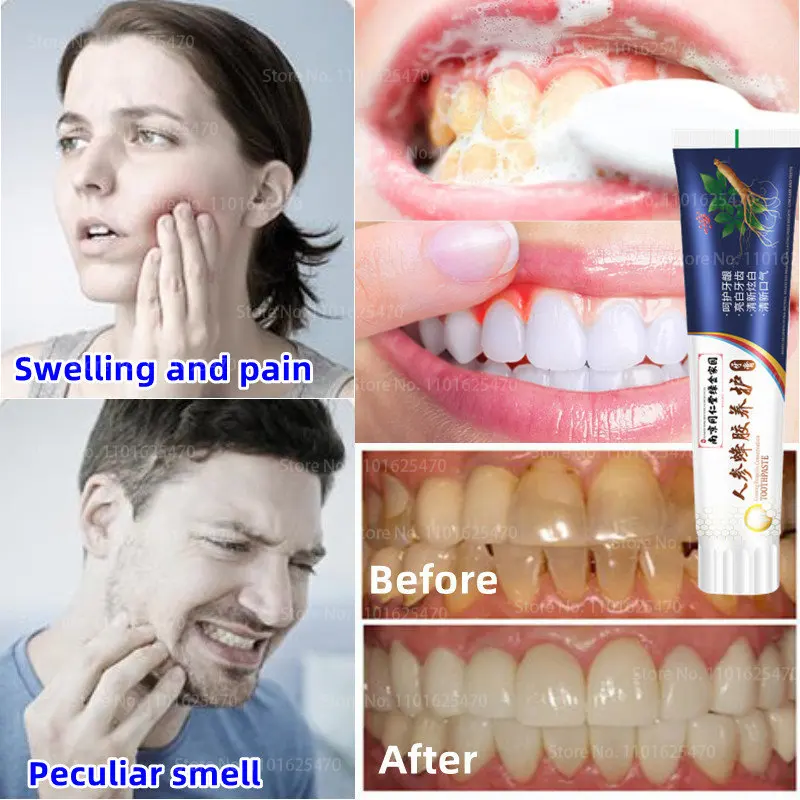 Ginseng Propolis Repair Toothpaste,Tooth Cleaning,Cavities,Caries,Filling,Removal Plaque,Stains,Decay,Yellowing Teeth Whitening