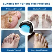 

1/2/4 Pcs Nail Fungus Light Device for Multiple Fingernails & Toenails