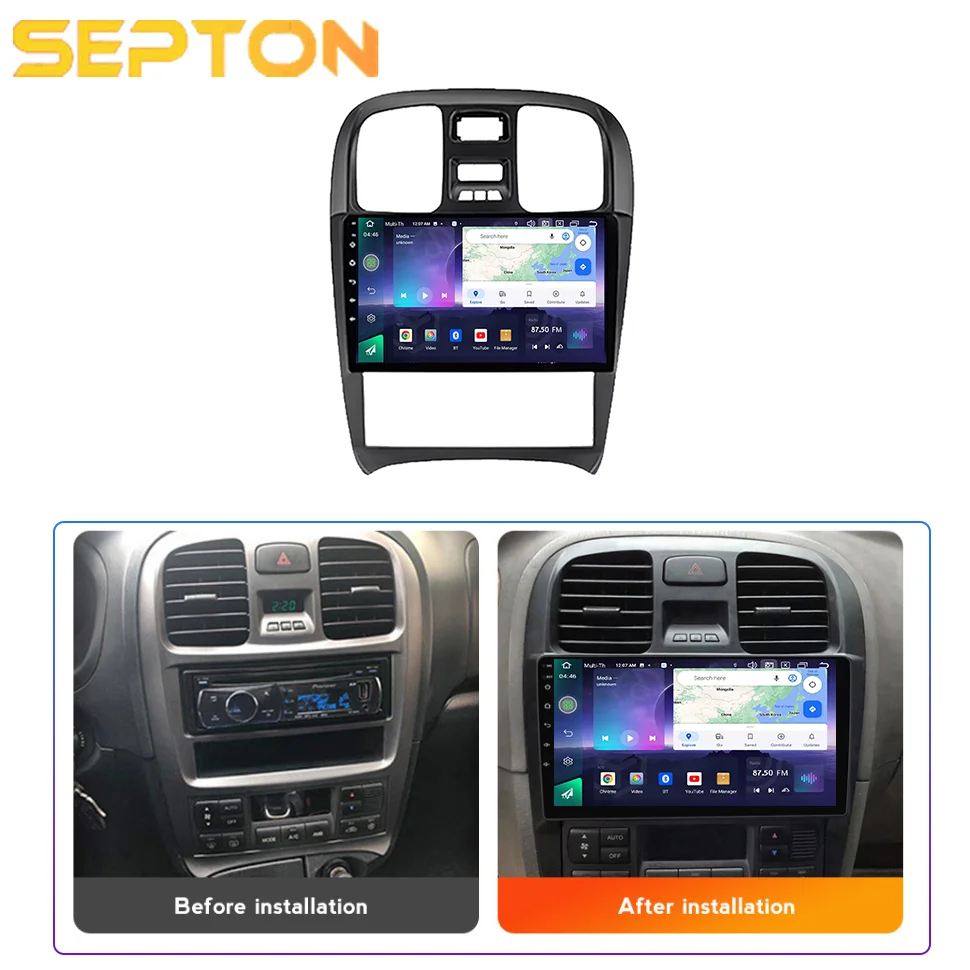 SEPTON Smart Car Systems Car Setero Radio Carplay for Hyundai Sonata 2003-2009 GPS BT 8core WiFi 8+256G Multimedia Head Unit