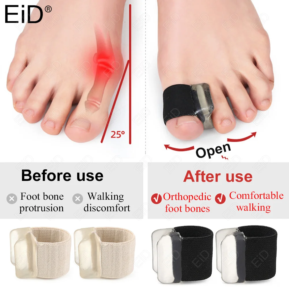 1pair Toe Separator Finger Feet Care Protector insoles Silicone Toe Orthopedic Product pad Bunion Corrector Hallux Valgus Unisex