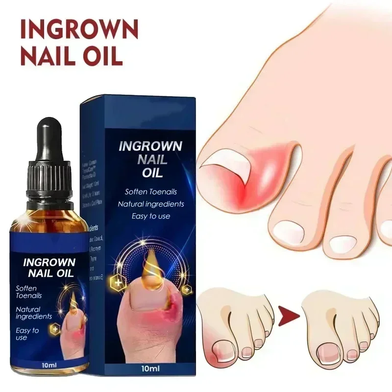 Zestaw do pielęgnacji paznokci 3ND Nail Nourish Technology Serum, narzędzia można kupować pojedynczo lub w połączeniu.