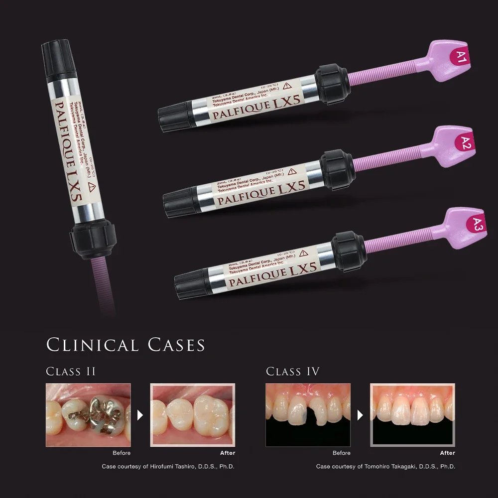 Améride: La Mejor Opción para Restauraciones Dentales con Compuesto Fotopolimerizable de Alta Performance