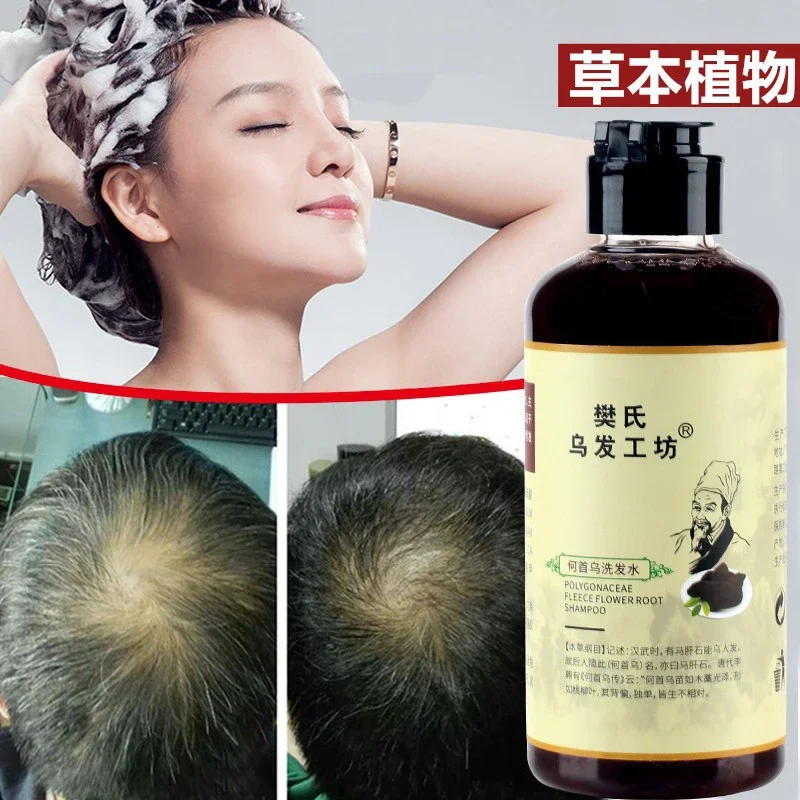 300ml Africa Women Traction Alopecia Treatment Hair Growth Product for Men Shampoo Hair Loss Treatment Get Rid of Wigs