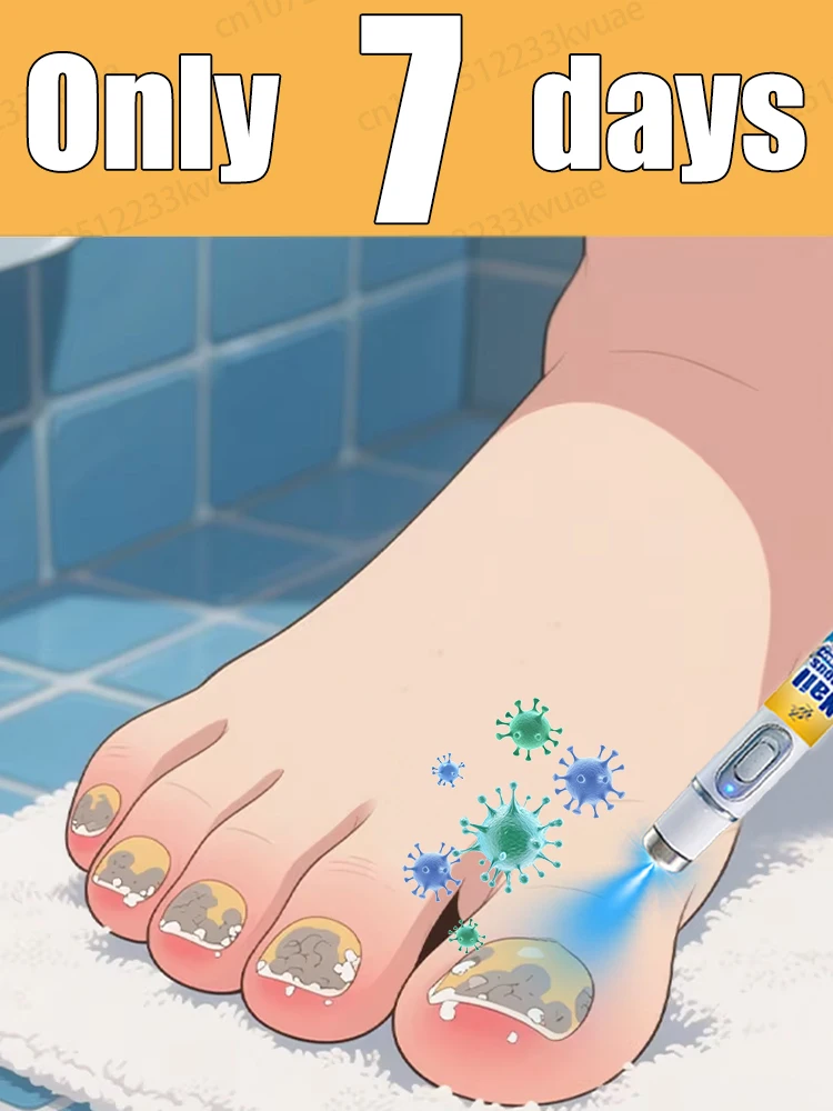 

Technology changes life, says goodbye to onychomycosis, and restores the natural luster of nails