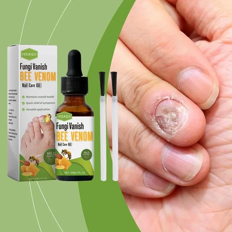 Nail Care Oil Foot Toe Nail Fungus Removal Essential Oil Anti Infection Onychomycosis Paronychia Repair Nutritional Care Serum