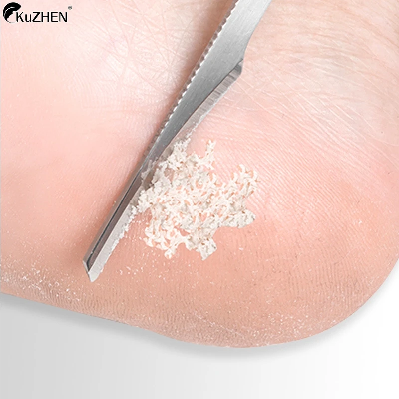 Pedicure Knife Callus Nail Trimming Tools To Remove Dead Skin Scraper Home Repair Foot Nail Groove Artifacts Foot Repair Tools