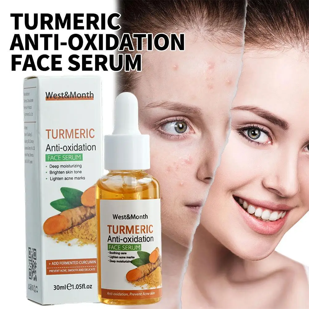 30ml curcuma Freckle Whitening Serum Anti-ossidante Brighten Repair Essence Face nutriente Dark Care Fade Spot Skin moisturur