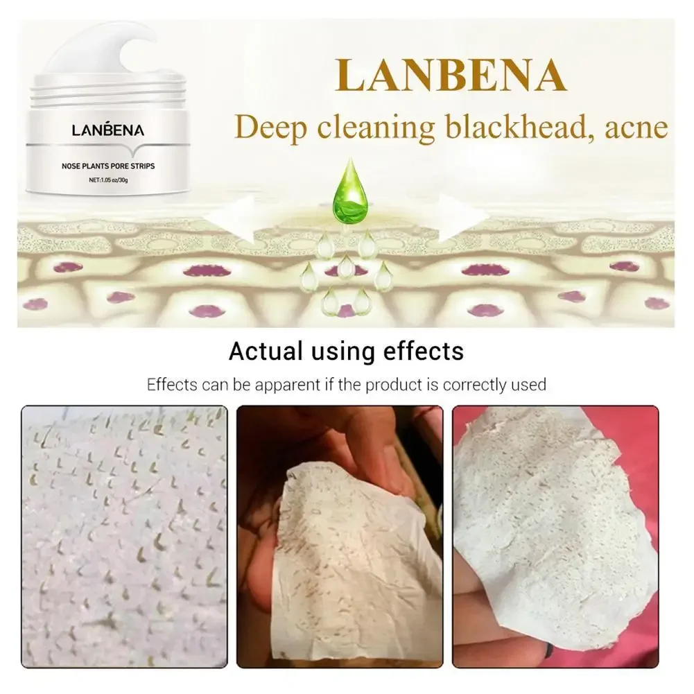 LANBENA-Papel Creme Removedor De Cravos, Tiras De Poros De Plantas, Limpeza De Acne Do Nariz, Pontos Pretos, Peel Off Mud Mask, Tratamentos, Cuidados Com A Pele