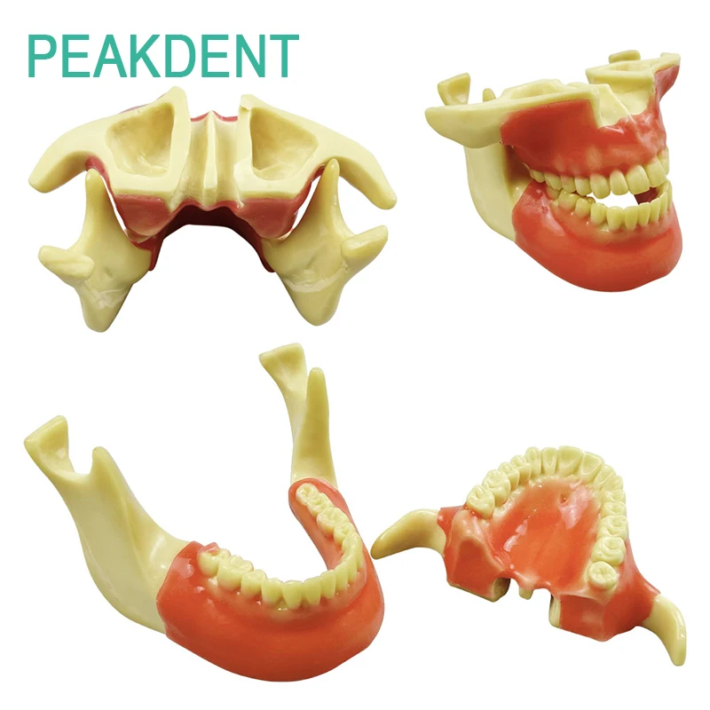 

Поддержка стоматологии, модель практики посадки ногтей, оральный зубной имплантат, обучающая модель для студентов-стоматолога, обучающая модель