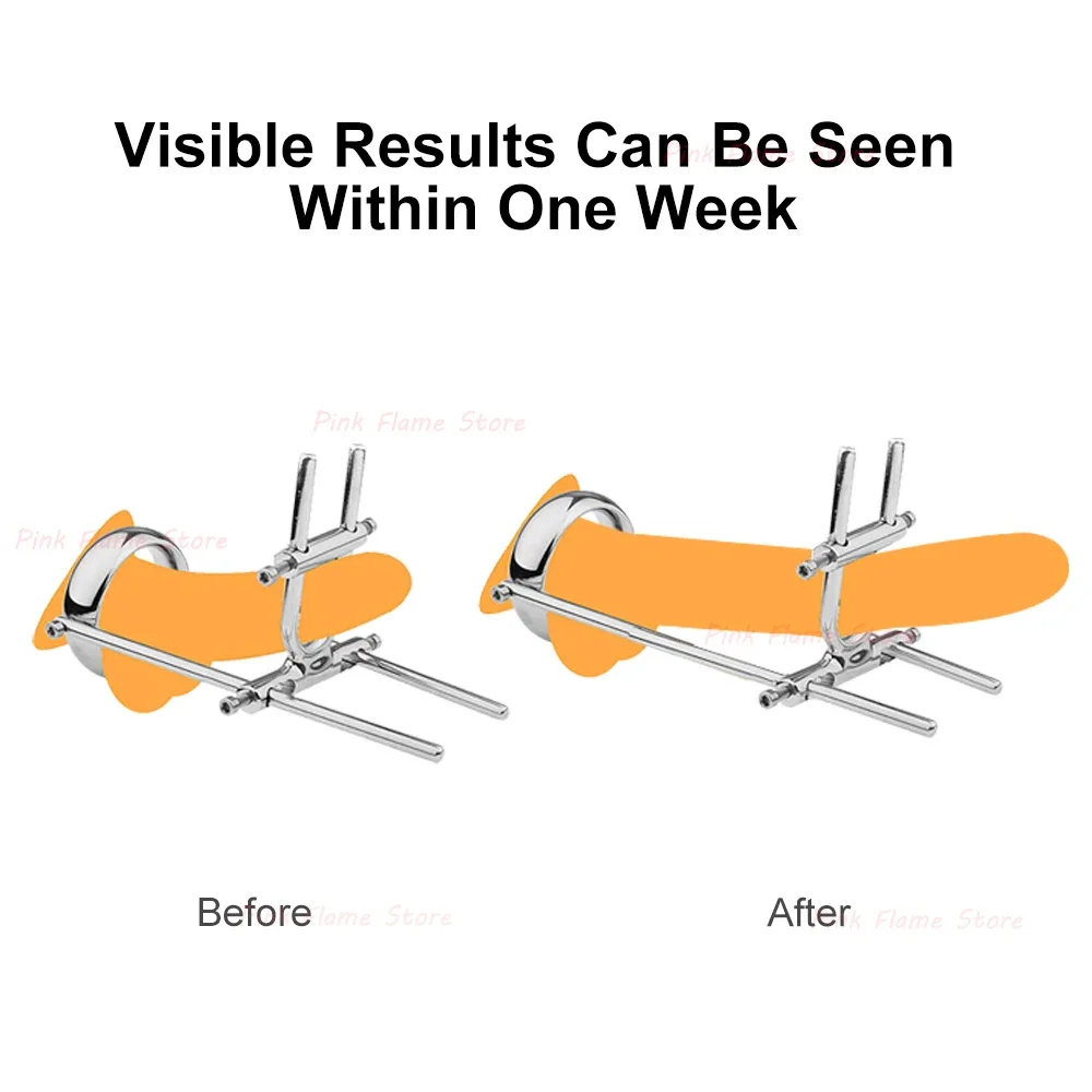 Metal Penis Stretcher Trainer Device for Men, Penis Enlargement, Cock Ring Bdsm Set, Physics Stretching, Sex Machine Toys