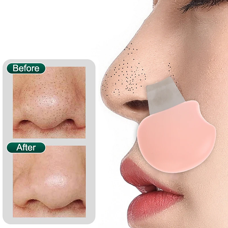 Mini pala Manual para limpieza de poros, elimina puntos negros y espinillas, limpieza Facial, herramienta de ajuste y elevación, limpiador de espinillas de nariz