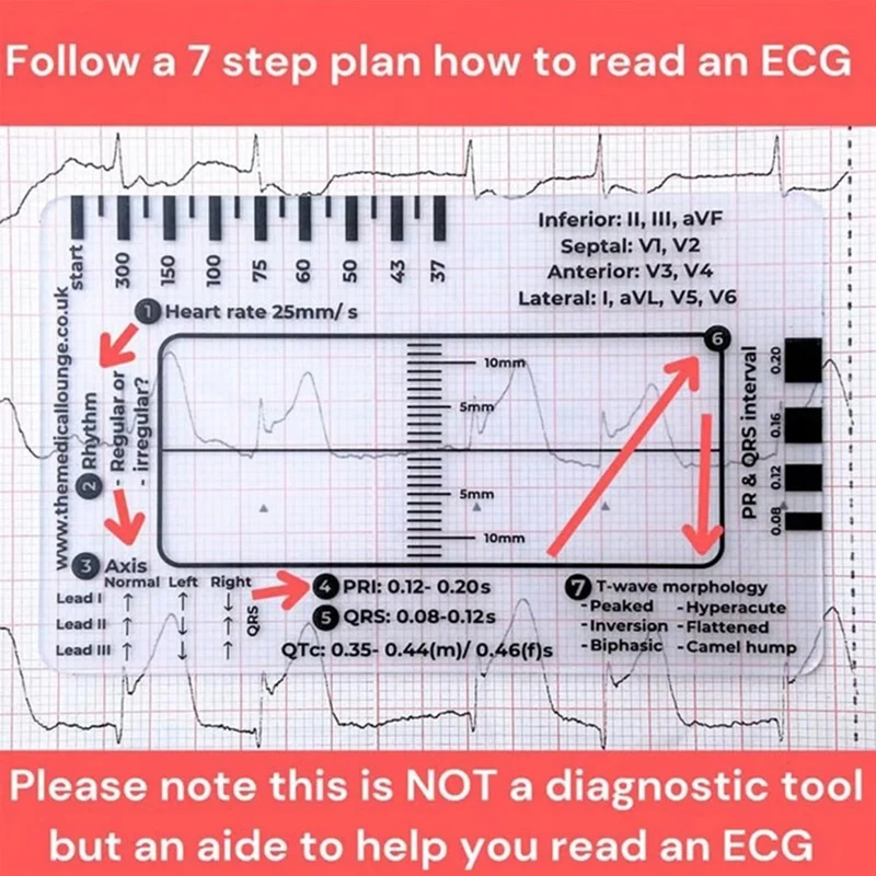 ECG 7 Step Ruler ECG Ruler Plastic Ruler Measuring Tool For ECG/EKG Interpretation Easy-To-Carry With 1 Protect Sheath