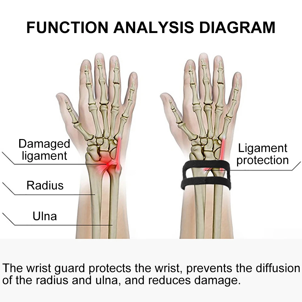 1 szt. Regulowana orteza nadgarstka podtrzymująca rozdarcie TFCC, trójkątne urazy z włókna szklanego, ból nadgarstka na skrzyń, naprężenie łożyska