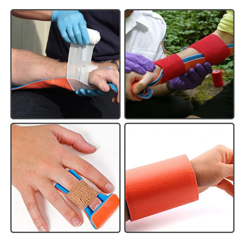 

Первая помощь при переломах на открытом воздухе с фиксированной шиной рулонного типа также можно использовать для домашних животных