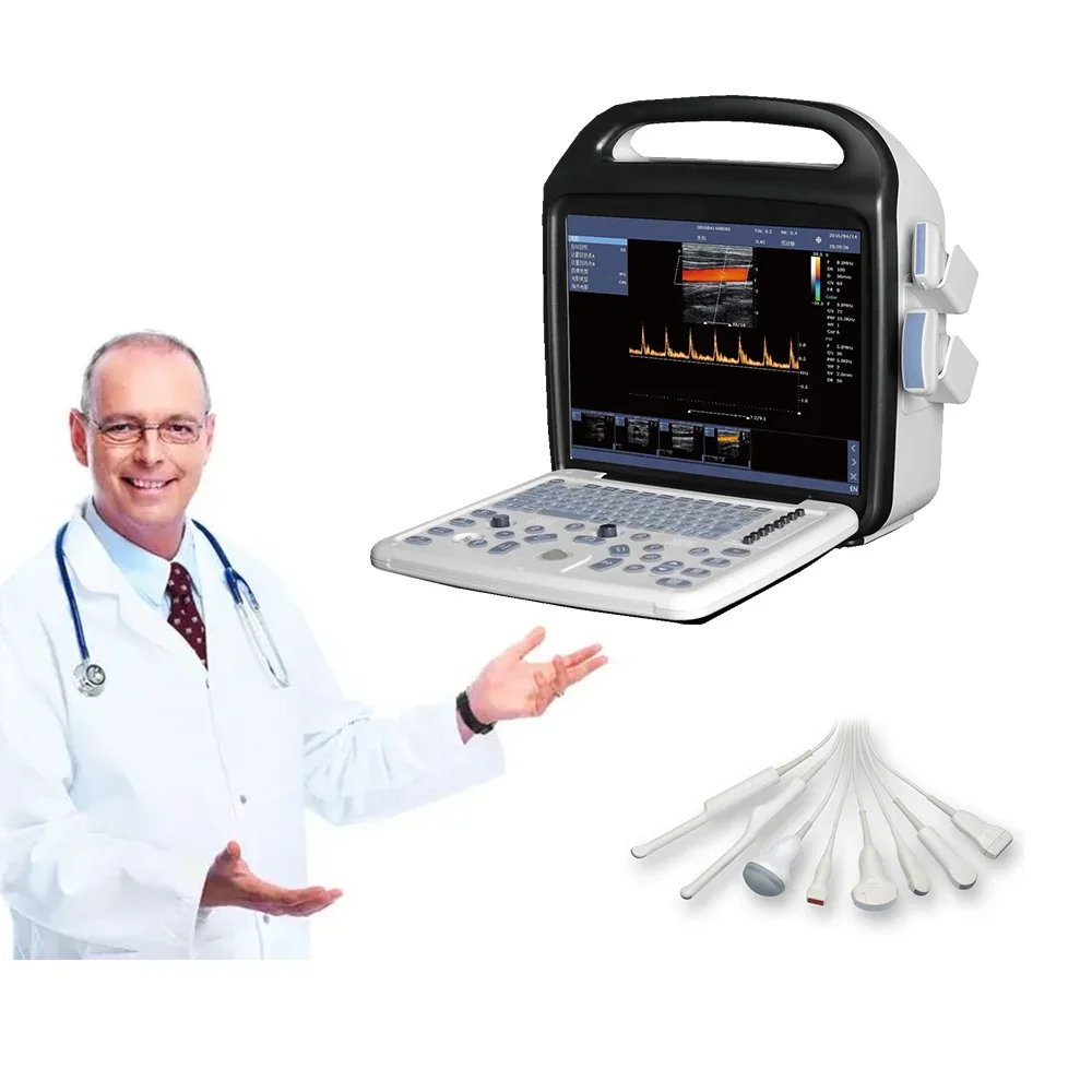 The professional color Doppler ultrasonic machine is also use in other medical fields, such as obstetrics and radiology