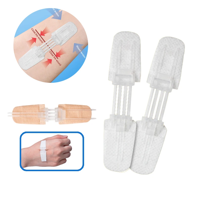 

1Pc Outdoor Portable Zipper Band-Aid Painless Wound Closure Patch Suture-free Wound Dressing Patches Zip Suture Reducer Band Aid