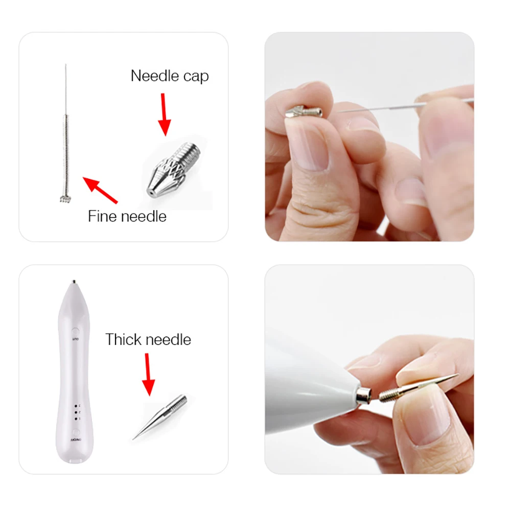 12Pcs Plasma Pen Replacement Needle Set Beauty Accessory For Facial Skin Care Dark Spot Freckle Treatment Beauty Device Supplies - view 4
