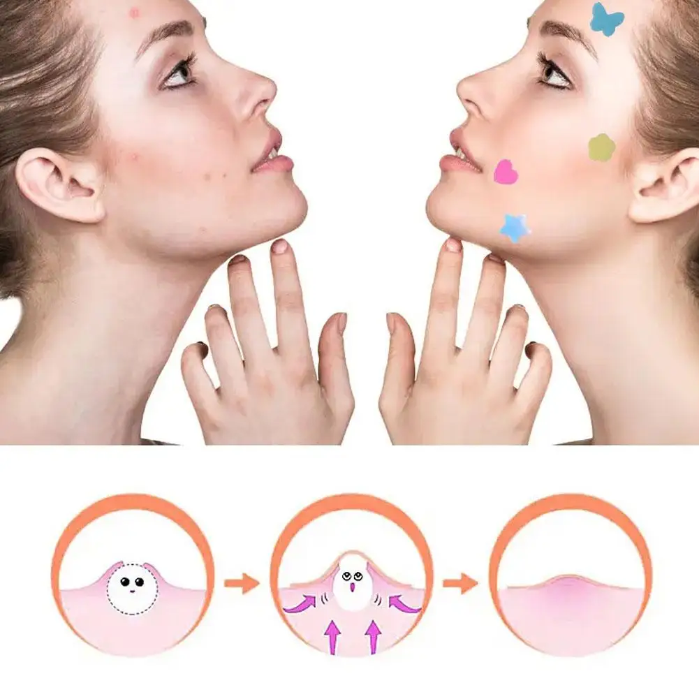 24 Stuks Schattige Mini Acne Verwijdering Puistje Patch Onzichtbare Ademende Anti-Bacteriële Concealer Verlicht Pijnherstel Schoonheid Make-Up Tools