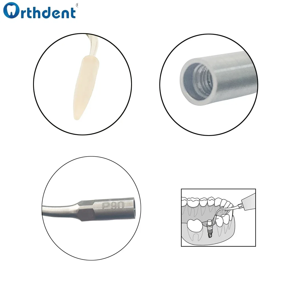 1Pc Dental Ultrasonic Scaler Tip P90 Fit For EMS/WOODPECKER Scalers Stainless Steel Periodontal Implant Abrasion Resistant Clean