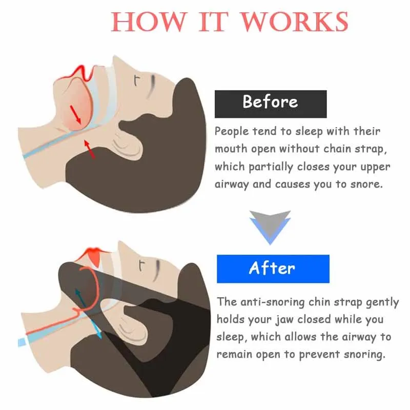 Anti Snore Belt Stop Snoring Chin Strap Woman Man Night Sleeping Aid Tools Snoring Protection Jaw Anti-snore Bandage One Size